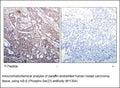 Anti-IkB-β (Phospho-Ser23) Antibody – Figure 1 of 1