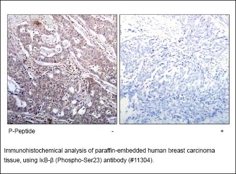 Anti-IkB-β (Phospho-Ser23) Antibody – Figure 1 of 1