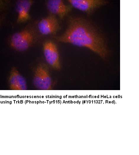 Anti-TrkB (Phospho-Tyr515) Antibody – Figure 1 of 1