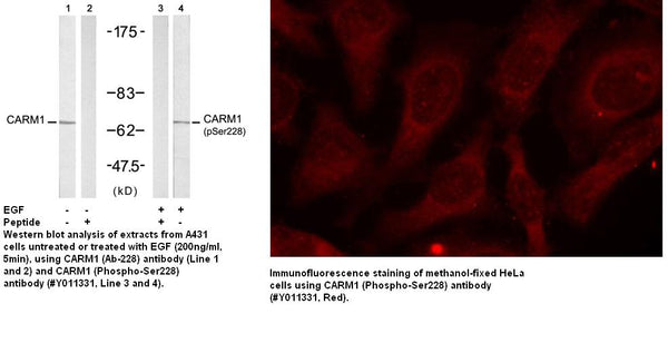Anti-CARM1 (Phospho-Ser228) Antibody – Figure 1 of 1