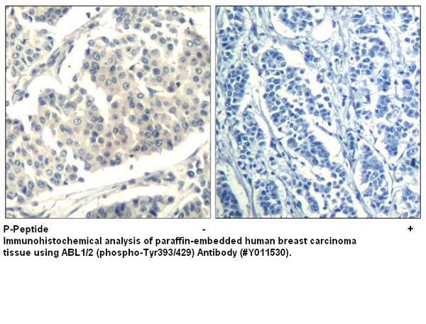 Anti-ABL1/2 (phospho-Tyr393/429) Antibody – Figure 1 of 1