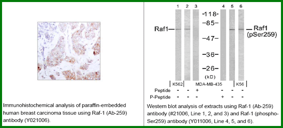 Anti-Raf1 (Ab-259) Antibody – Figure 1 of 1