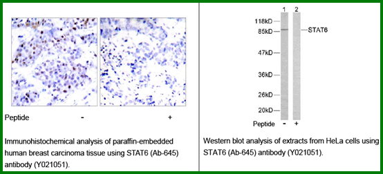 Anti-STAT6 (Ab-645) Antibody – Figure 1 of 1