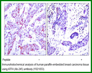 Anti-ATF4 (Ab-245) Antibody – Figure 1 of 1