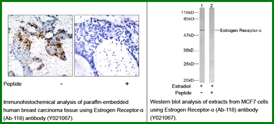 Anti-Estrogen Receptor-β (Ab-118) Antibody – Figure 1 of 1