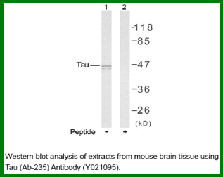 Anti-Tau (Ab-235) Antibody – Figure 1 of 1