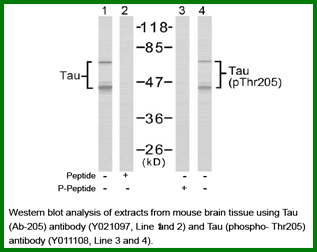 Anti-Tau (Ab-205) Antibody – Figure 1 of 1