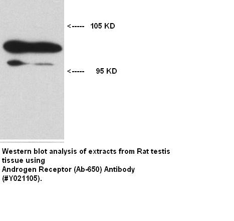 Anti-Androgen Receptor (Ab-650) Antibody – Figure 1 of 1