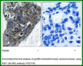 Anti-ASK1(Ab-966) Antibody – Figure 1 of 1