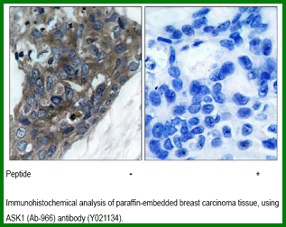 Anti-ASK1(Ab-966) Antibody – Figure 1 of 1