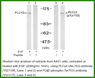 Anti-PLCγ2 (Ab-753) Antibody – Figure 1 of 1