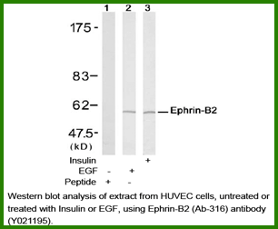 Anti-Ephrin-B2 (Ab-316) Antibody – Figure 1 of 1