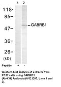 Anti-GABRB1 (Ab-434) Antibody – Figure 1 of 1