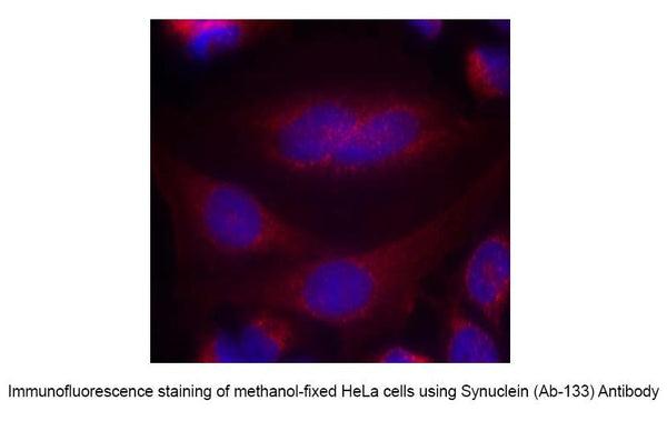 Anti-Synuclein (Ab-133) Antibody – Figure 1 of 1