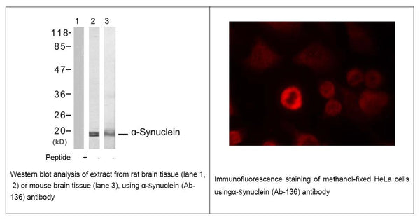 Anti-β-Synuclein (Ab-136) Antibody – Figure 1 of 1