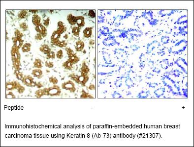 Anti-Keratin 8 (Ab-73) Antibody – Figure 1 of 1