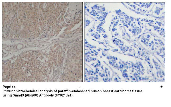 Anti-Smad3 (Ab-208) Antibody – Figure 1 of 1
