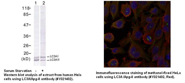 Anti-LC3A/Apg-8 Antibody – Figure 1 of 1