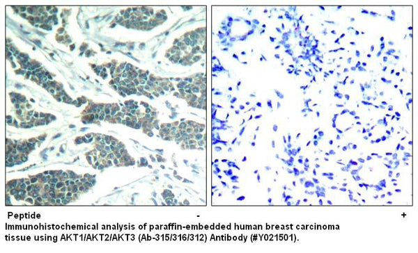 Anti-AKT1/AKT2/AKT3 (Ab-315/316/312) Antibody – Figure 1 of 1