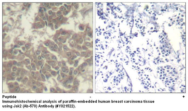 Anti-Jak2 (Ab-570) Antibody – Figure 1 of 1