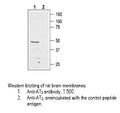 Anti-Angiotensin II Receptor (AT2 Receptor) (extracellular) Antibody – Figure 1 of 1