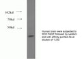 Anti Human FADS1 Polyclonal Antibody – Figure 1 of 1
