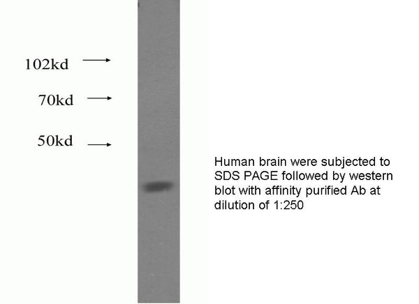 Anti Human FADS1 Polyclonal Antibody – Figure 1 of 1