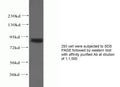 Anti Human SPHK1 Polyclonal Antibody – Figure 1 of 1