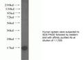 Anti Human TTC11 Polyclonal Antibody – Figure 1 of 1