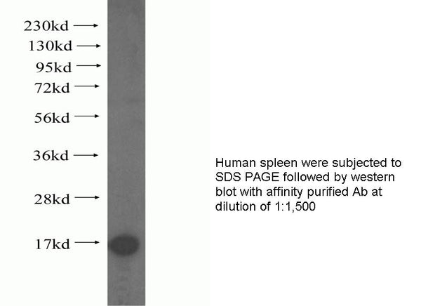 Anti Human TTC11 Polyclonal Antibody – Figure 1 of 1