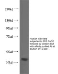 Anti Human HSD17B2 Polyclonal Antibody – Figure 1 of 1