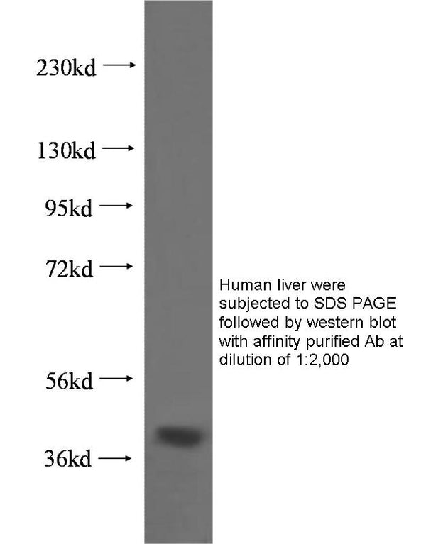Anti Human HSD17B2 Polyclonal Antibody – Figure 1 of 1