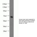 Anti Human PGM2 Polyclonal Antibody – Figure 1 of 1