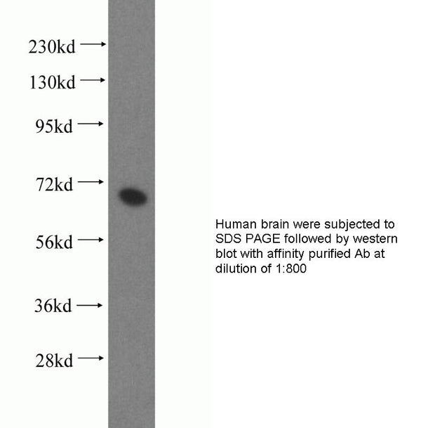 Anti Human PGM2 Polyclonal Antibody – Figure 1 of 1