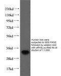 Anti Human ING2 Polyclonal Antibody – Figure 1 of 1