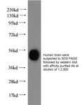 Anti Human ERRFI1 Polyclonal Antibody – Figure 1 of 1