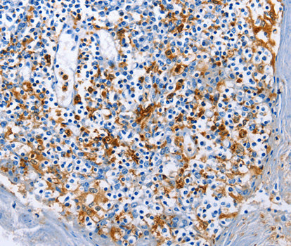 Anti-AIF1 Antibody – Figure 1 of 1