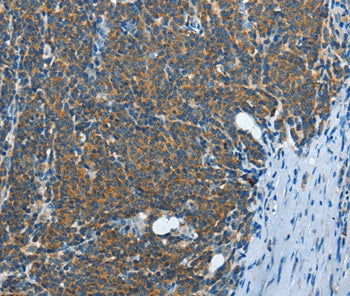Anti-IL13RA2 Antibody – Figure 1 of 1
