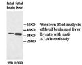 Anti-ALAD Antibody – Figure 1 of 1
