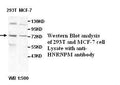Anti-HNRNPM Antibody – Figure 1 of 1