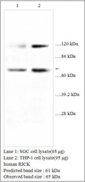 Anti-human RICK Antibody – Figure 1 of 1