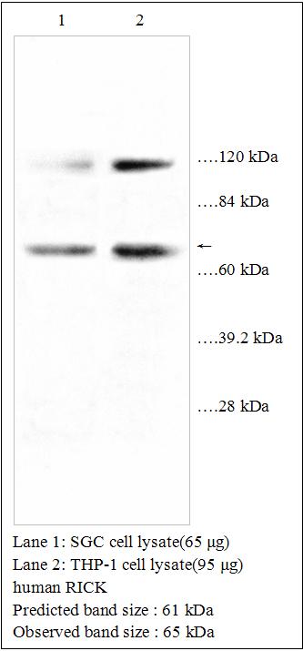 Anti-human RICK Antibody – Figure 1 of 1
