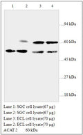 Anti-ACAT 2 Antibody – Figure 1 of 1