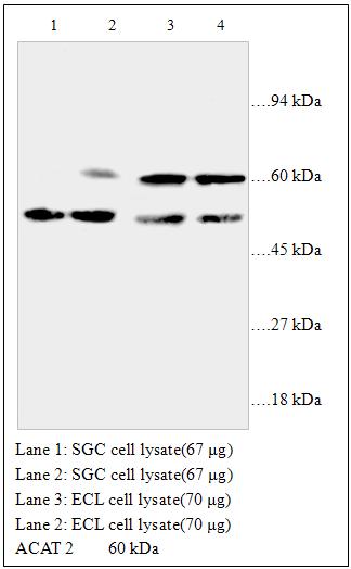 Anti-ACAT 2 Antibody – Figure 1 of 1