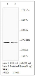 Anti-RPS2 Antibody – Figure 1 of 1