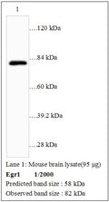 Anti-Egr1 Antibody – Figure 1 of 1