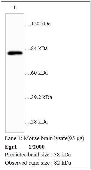 Anti-Egr1 Antibody – Figure 1 of 1
