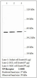 Anti-TP Receptor Antibody – Figure 1 of 1