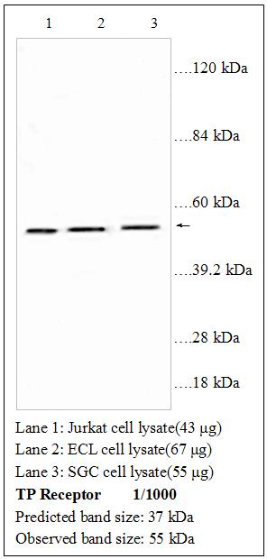 Anti-TP Receptor Antibody – Figure 1 of 1