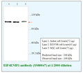 Anti-EIF4ENIF1 Antibody – Figure 1 of 1
